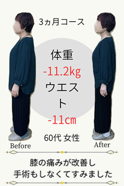 施術効果を持続させるために、ホームケアのご指導をさせていただきます。日常生活のちょっとした身体の使い方で再発予防ができます。