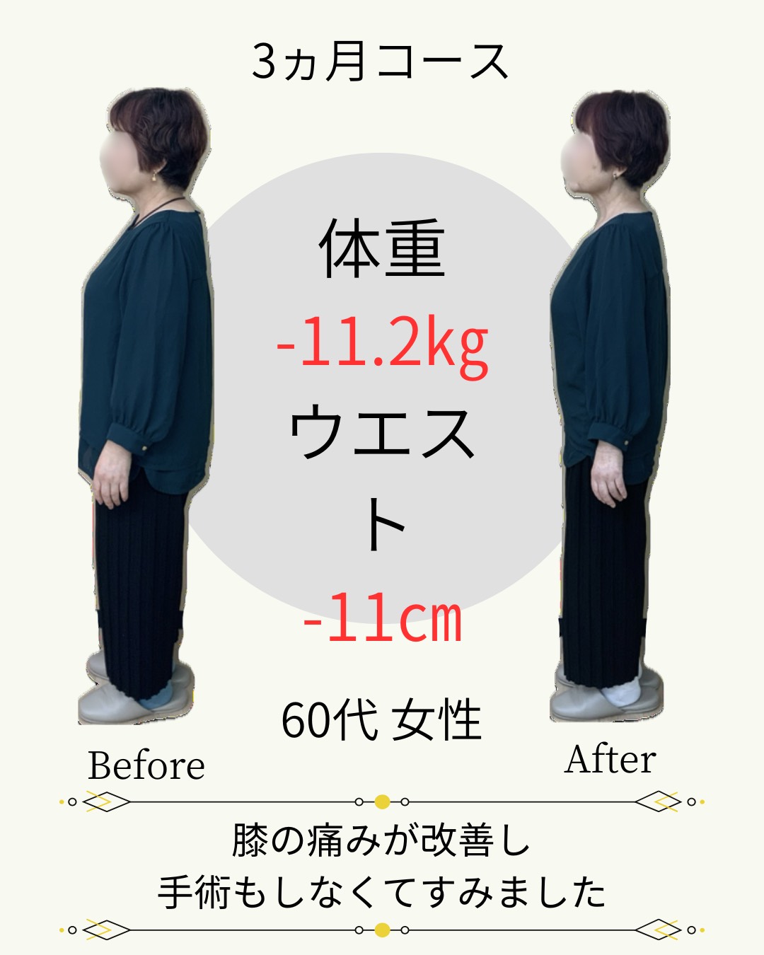 60代　体重-11.2kg　ウエスト-11cm　膝の痛みが改善して手術もしなくて済みました