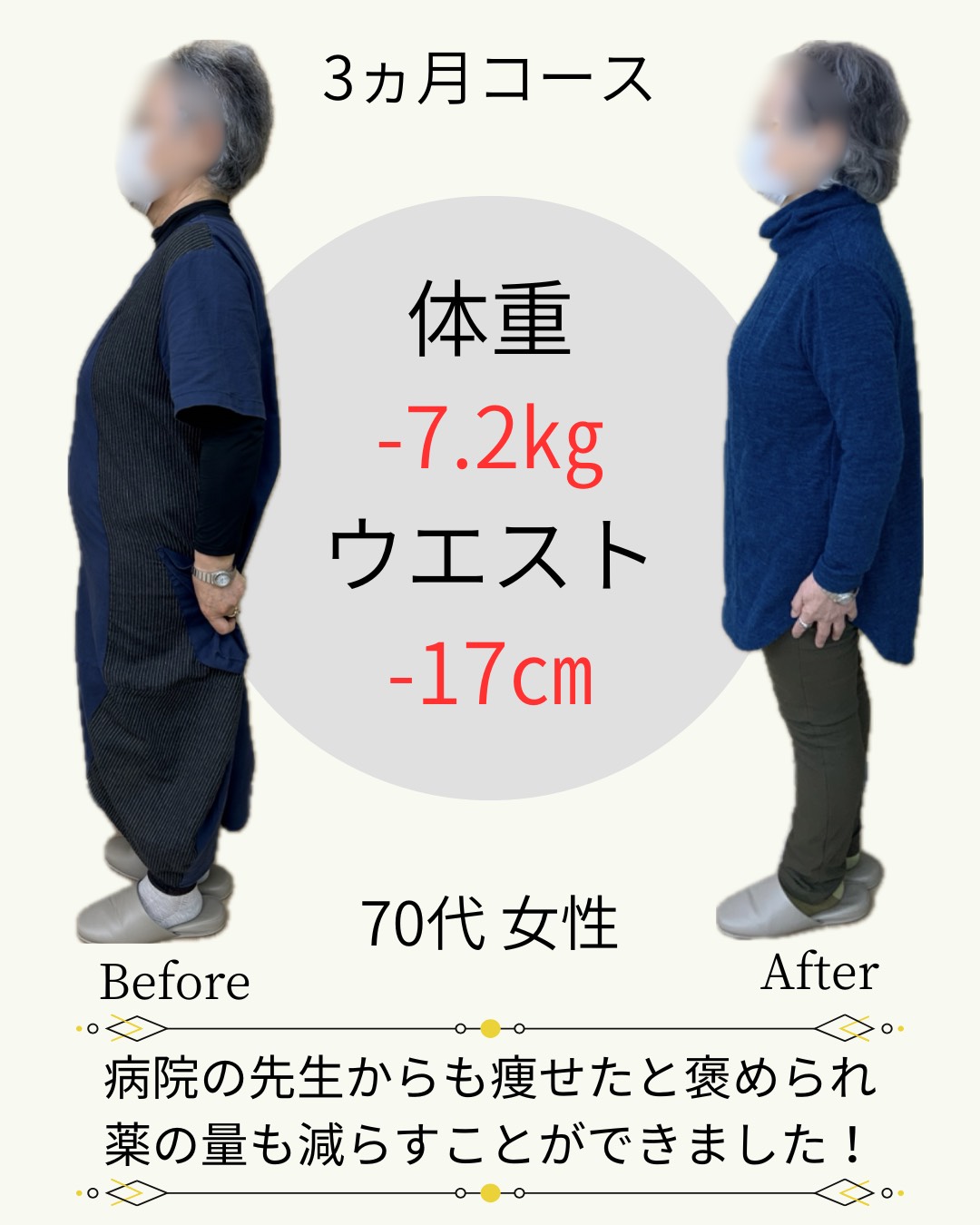 70歳-7.2kg　ウエスト-17cm　病院の先生からも痩せたとほめられ薬の量も減らすことが出来ました！